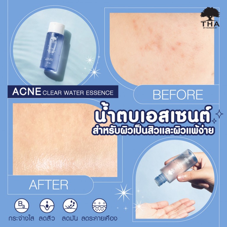 THA BY NONGCHAT Acne Clear Water Essence 50ml 