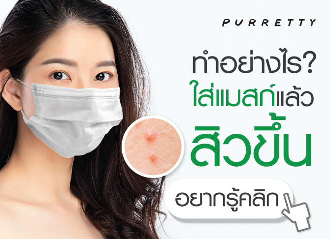 ทำอย่างไร ใส่แมสก์แล้วสิวขึ้น