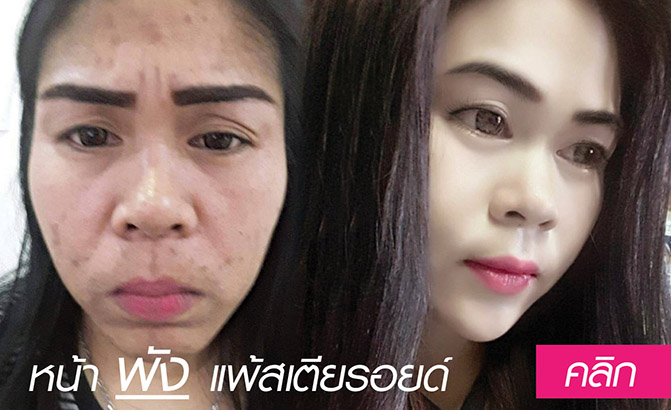 กอบกู้หน้าพัง ให้กลับมาปัง! อย่างมั่นใจ